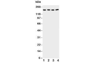 Western blot testing of CPLA2 antibody and Lane 1:  rat testis;  2: (r) brain;  3: human A549;  4: (h) COLO320 cell lysate. (PLA2G4A 抗体  (C-Term))