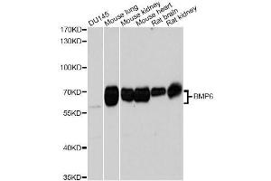 Western blot analysis of extracts of various cell lines, using BMP6 Antibody. (BMP6 抗体  (AA 100-200))