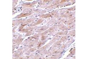 Immunohistochemistry of TRPC3 in mouse heart tissue with this product at 10 μg/ml. (TRPC3 抗体  (N-Term))