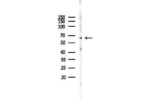 Western blot analysis of lysates from EC304 cells(starvation 24h treatment), using UG Antibody at 1/1000 dilution.