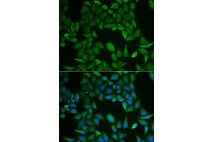 Immunofluorescence analysis of HeLa cell using CLPS antibody. (CLPS 抗体)