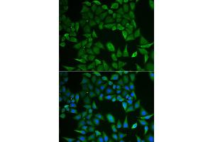 Immunofluorescence analysis of HeLa cell using CLPS antibody. (CLPS 抗体)