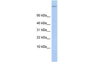 Western Blotting (WB) image for anti-TSC22 Domain Family, Member 1 (TSC22D1) antibody (ABIN2458107) (TSC22D1 抗体)