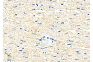 ABIN6260179 and ABIN6279190 at 1/100 staining Rat heart tissue by IHC-P. (B4GALT7 抗体)