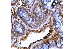IHC analysis of XRCC4 using anti-XRCC4 antibody (ABIN7599055).