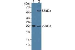 Western blot analysis of (1) Mouse Sp2/0 Cells and (2) Mouse Placenta Tissue. (DC-SIGN/CD209 抗体  (AA 70-404))