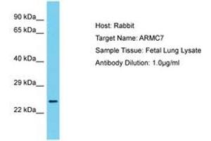 Image no. 1 for anti-Armadillo Repeat Containing 7 (ARMC7) (N-Term) antibody (ABIN6750673) (ARMC7 抗体  (N-Term))