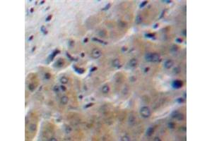 IHC-P analysis of Liver tissue, with DAB staining. (Apolipoprotein F 抗体  (AA 122-307))