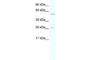 WB Suggested Anti-ASCL2 Antibody Titration:  5. (ASCL2 抗体  (Middle Region))