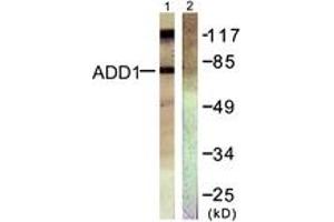 Western blot analysis of extracts from HeLa cells, treated with Forskolin 40nM 30', using ADD1 (Ab-726) Antibody. (alpha Adducin 抗体  (AA 688-737))