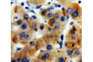 IHC-P analysis of Liver tissue, with DAB staining. (ADAMTS7 抗体  (AA 1589-1686))