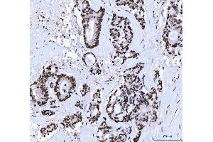 IHC analysis of CTBP2 using anti-CTBP2 antibody (ABIN7601326). (CTBP2 抗体  (AA 321-445))