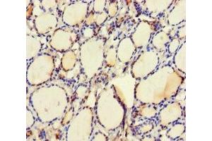 Immunohistochemistry of paraffin-embedded human thyroid tissue using ABIN7174476 at dilution of 1:100