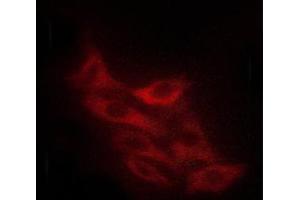 Immunofluorescence (fixed cells) (IF/ICC) image for anti-C-Abl Oncogene 1, Non-Receptor tyrosine Kinase (ABL1) (pTyr393), (pTyr412) antibody (ABIN6256727)