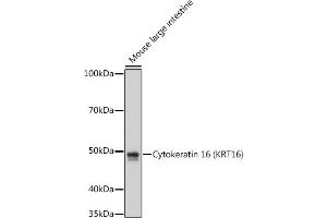 Western blot analysis of extracts of Mouse large intestine cells, using Cytokeratin 16 (KRT16) antibody (ABIN7268094) at 1:1000 dilution. (KRT16 抗体)