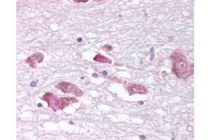 Immunohistochemical (Formalin/PFA-fixed paraffin-embedded sections) staining of human substantia nigra in brain. (MCHR1 抗体)