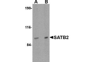 Western Blotting (WB) image for anti-SATB Homeobox 2 (SATB2) (N-Term) antibody (ABIN1031555) (SATB2 抗体  (N-Term))