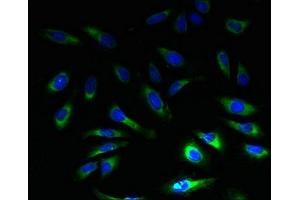 Immunofluorescence (IF) image for anti-Solute Carrier Family 1 (High Affinity Aspartate/glutamate Transporter), Member 6 (SLC1A6) (AA 149-271) antibody (ABIN7152238)