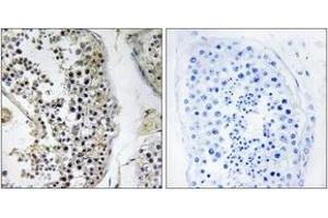 Immunohistochemistry analysis of paraffin-embedded human testis tissue, using CEP170 Antibody. (CEP170 抗体  (AA 701-750))