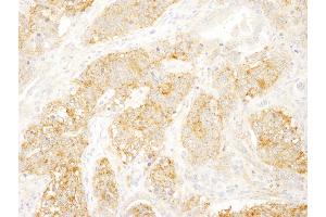 Immunohistochemistry (IHC) image for anti-Eukaryotic Translation Initiation Factor 3, Subunit B (EIF3B) (AA 100-150) antibody (ABIN7448960)