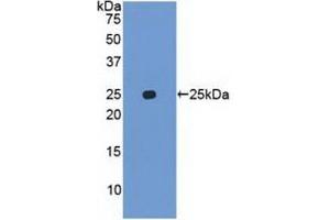 Detection of Recombinant UBD, Human using Polyclonal Antibody to Ubiquitin D (UBD) (UBD 抗体  (AA 1-165))