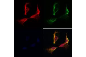 ABIN7093908 and ABIN7097952 staining Hela cells by IF/ICC.
