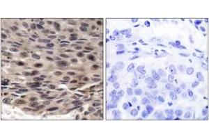 Immunohistochemistry (IHC) image for anti-Eukaryotic Translation Initiation Factor 4E Binding Protein 1 (EIF4EBP1) (AA 4-53), (pThr37) antibody (ABIN1531763)
