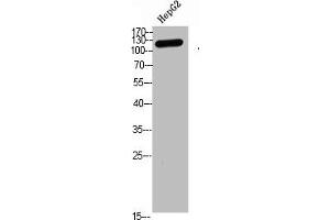 Western blot analysis of hepg2 Cell Lysate, antibody was diluted at 1:1000 (TERT 抗体  (AA 1268-1341))