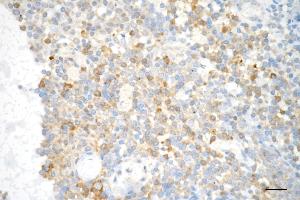 Immunohistochemistry was performed on paraffin-embedded human tonsillitis using pro caspase 3 antibody (ABIN7799901), 1:200). (Recombinant Pro Caspase 3 抗体)