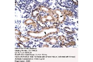 Human kidney (TRIM3 抗体  (N-Term))