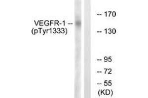 Western blot analysis of extracts from K562 cells treated with etoposide 25uM 24h, using VEGFR1 (Phospho-Tyr1333) Antibody. (FLT1 抗体  (pTyr1333))