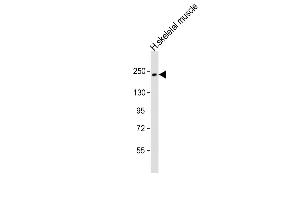 Anti-MYH7 Antibody (N-term) at 1:1000 dilution + human skeletal muscle lysate Lysates/proteins at 20 μg per lane. (MYH7 抗体  (N-Term))