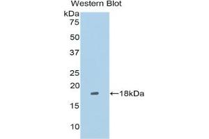 Western blot analysis of the recombinant protein. (LRRFIP1 抗体  (AA 128-250))