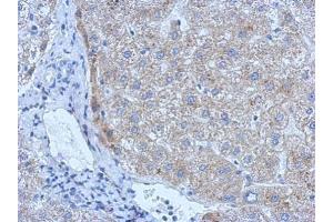 Immunohistochemistry (IHC) image for anti-Plasminogen Activator, Tissue (PLAT) antibody (ABIN2855635)