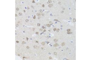 Immunohistochemistry (Paraffin-embedded Sections) (IHC (p)) image for anti-Protein Phosphatase 1, Catalytic Subunit, gamma Isoform (PPP1CC) (AA 1-323) antibody (ABIN1682257)