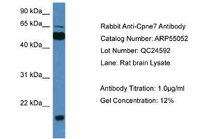 WB Suggested Anti-Cpne7  Antibody Titration: 0. (CPNE7 抗体  (C-Term))