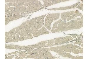 ABIN6259225 and ABIN6273402 at 1/100 staining human tongue carcinoma by IHC-P. (TCAP 抗体  (N-Term))