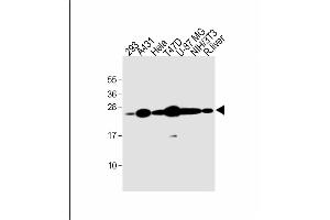 All lanes : Anti-RAB1B Antibody (C-term) at 1:2000 dilution Lane 1: 293 whole cell lysate Lane 2: A431 whole cell lysate Lane 3: Hela whole cell lysate Lane 4: T47D whole cell lysate Lane 5: U-87 MG whole cell lysate Lane 6: NIH/3T3 whole cell lysate Lane 7: rat liver lysate Lysates/proteins at 20 μg per lane. (RAB1B 抗体  (C-Term))