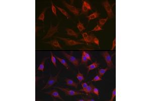Immunofluorescence analysis of NIH-3T3 cells using CX3CL1 Rabbit pAb (ABIN6129035, ABIN6139265, ABIN6139266 and ABIN6218481) at dilution of 1:100 (40x lens). (CX3CL1 抗体  (AA 365-397))