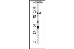 Western blot analysis of ERVFRDE1 / HERV-FRD Antibody (N-term) in NCI-H460 cell line lysates (35ug/lane). (HERV-FRD Provirus Ancestral Env Polyprotein (Herv-frd) (AA 78-107), (N-Term) 抗体)