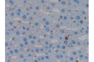 Detection of ICAM1 in Rat Liver Tissue using Polyclonal Antibody to Intercellular Adhesion Molecule 1 (ICAM1)