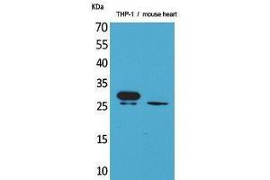 Western Blotting (WB) image for anti-Triggering Receptor Expressed On Myeloid Cells 1 (TREM1) (Internal Region) antibody (ABIN3178164) (TREM1 抗体  (Internal Region))