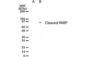 Image no. 1 for anti-Poly (ADP-Ribose) Polymerase 1 (PARP1) antibody (ABIN207909) (PARP1 抗体)
