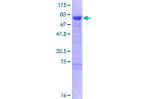 RBM17 Protein (AA 1-401) (GST tag)