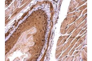 IHC-P Image Monoglyceride lipase antibody detects Monoglyceride lipase protein at nucleus on mouse esophagus by immunohistochemical analysis. (MGLL 抗体)