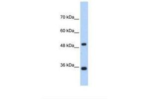Image no. 1 for anti-Fructose-1,6-Bisphosphatase 1 (FBP1) (AA 114-163) antibody (ABIN1494672) (FBP1 抗体  (AA 114-163))