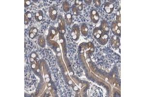 Immunohistochemical staining of human duodenum with MAMDC2 polyclonal antibody  shows moderate cytoplasmic positivity in glandular cells. (MAMDC2 抗体)
