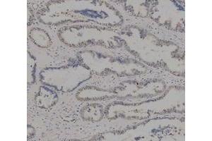 IHC analysis of ADK using anti-ADK antibody (ABIN4886430). (ADK 抗体  (AA 165-351))
