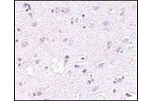 Immunohistochemistry of LASS5 in human brain tissue with this product at 2. (LASS5 抗体  (N-Term))