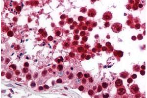 Immunohistochemistry (Paraffin-embedded Sections) (IHC (p)) image for anti-Sterol Regulatory Element Binding Transcription Factor 2 (SREBF2) (AA 455-469) antibody (ABIN2451790)